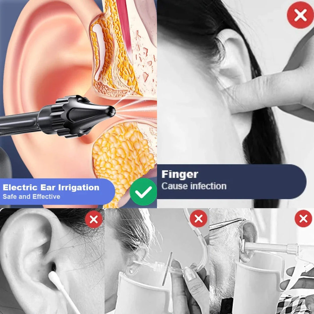 Vikbua™ Oppladbar ørerenser med vannstråle og 3 trykknivåer